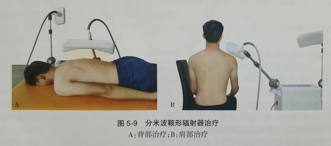 微波怎么治疗微波治疗_https://www.jmylbn.com_新闻资讯_第8张