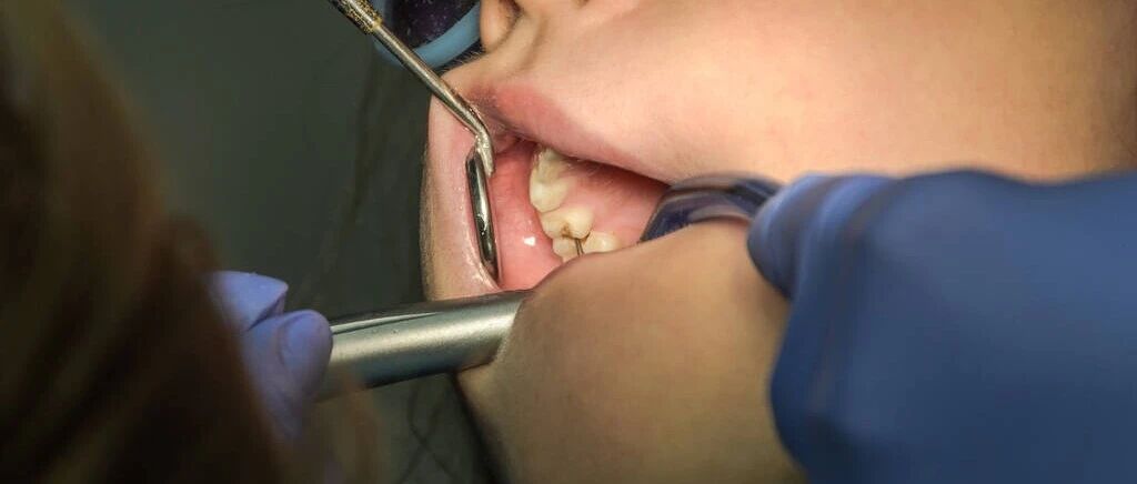 江西省中医院口腔科开展全程数字化植骨修复、同期种植