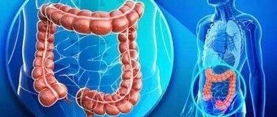 无症状也会得癌症？  ——大肠癌，是最容易预防的癌症