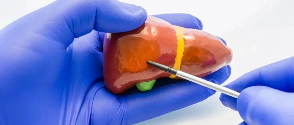 体检发现肝功能异常不要急！这份 “ 指南 ” 请收藏~