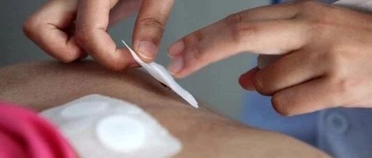 反复感冒咳喘？全身乏力怕冷？来省中肺病科试试三伏贴！文末有福利放送哦~~