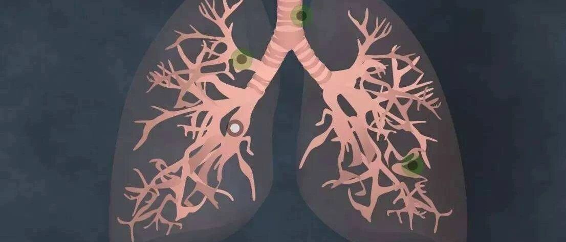 被判“死刑”，死马当活马医，奇迹出现了！