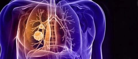 找到抗酸杆菌就一定是肺结核吗？看完这篇文章你就清楚了……