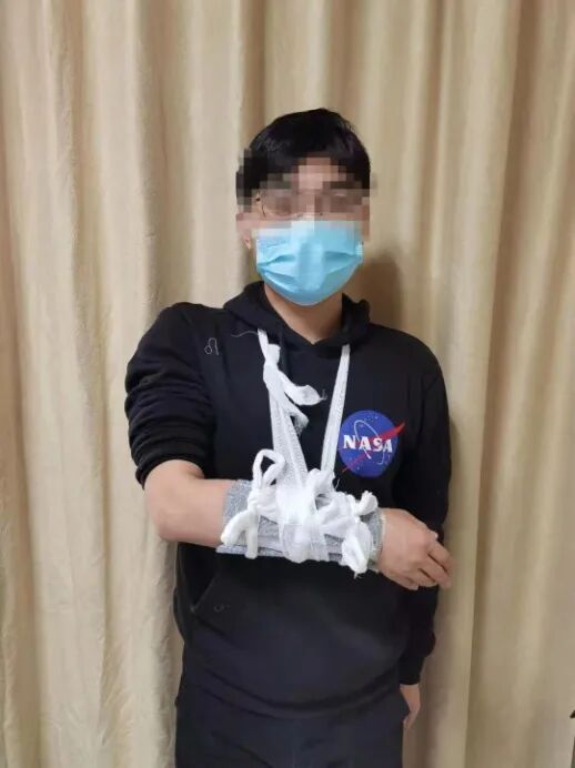 医用骨夹板怎么用骨折了手术治疗or保守治疗？小小夹板来助力_https://www.jmylbn.com_新闻资讯_第6张