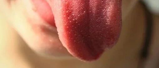 小小舌头竟是“健康晴雨表”，它一旦出现这几种颜色变化，你就要注意了！