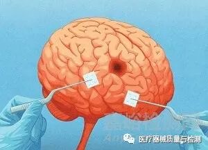 什么是创新医疗器械2021年最具创新性的24个医疗器械_https://www.jmylbn.com_新闻资讯_第16张