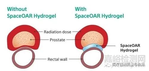 什么是创新医疗器械2021年最具创新性的24个医疗器械_https://www.jmylbn.com_新闻资讯_第9张