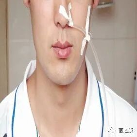 吞咽5900怎么使用鼻饲管病人的吞咽预后和这些因素相关..._https://www.jmylbn.com_新闻资讯_第2张