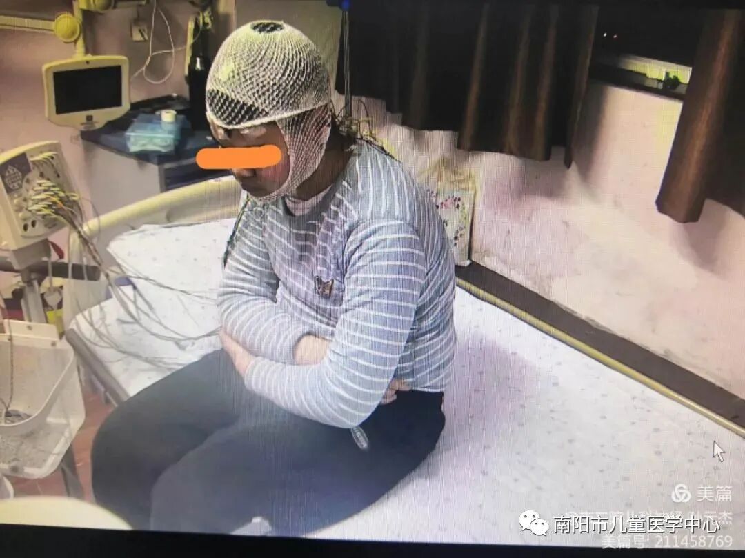 日本光电脑电图怎么样简单便利、优势显著的视频脑电图_https://www.jmylbn.com_新闻资讯_第3张