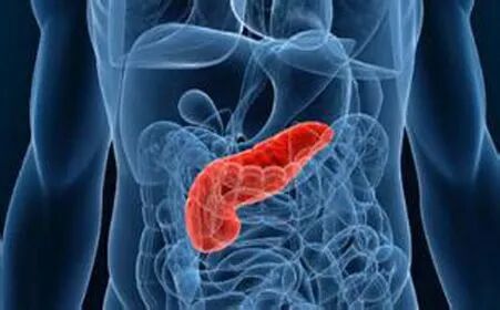 JAMA：胰腺癌患者存活时间竟由这四种基因决定！