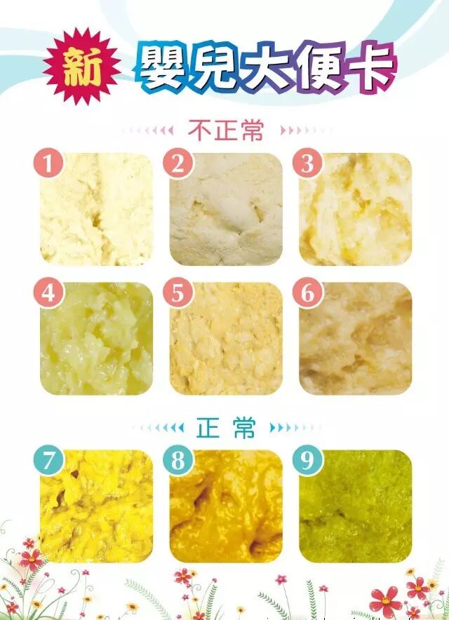 母乳宝宝的正常大便——金黄色的软糊便3.