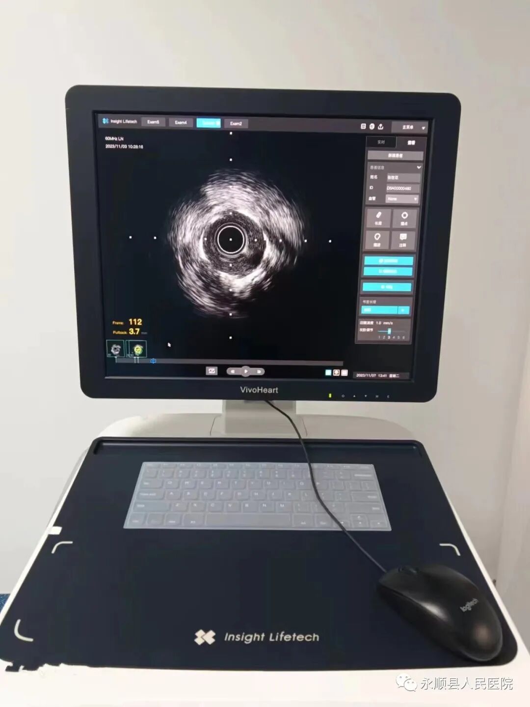 sm什么是医疗【卓越医疗】我院引进首台血管内超声（IVUS）设备，成功开展首例血管内超声检查术！-上海聚慕医疗器械有限公司