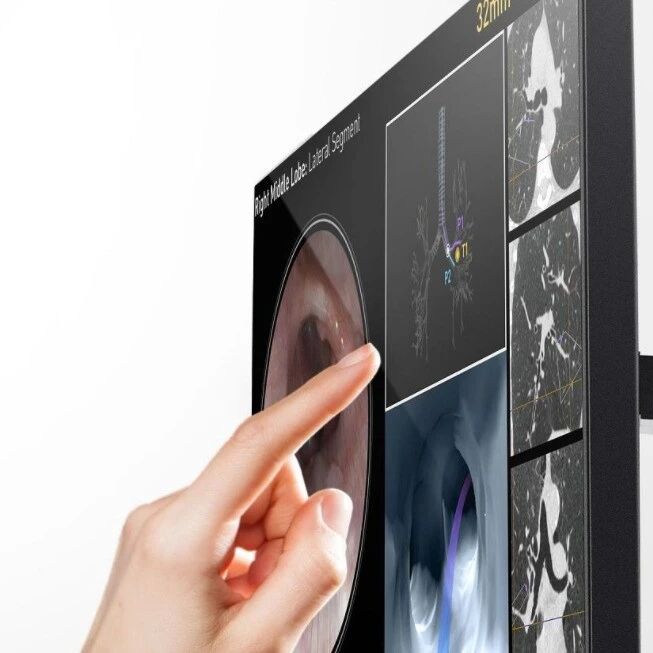 强生微软联手！手术机器人打响数字战