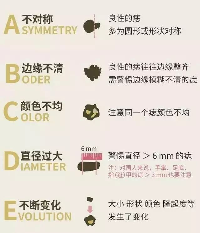 黑痣确诊恶性肿瘤,杭州阿姨后怕不已:差点就晚了!身上这些痣,一定盯紧…-微信头条网 黑痣确诊恶性肿瘤,杭州阿姨后怕不已:差点就晚了!身上这些痣,一定盯紧…