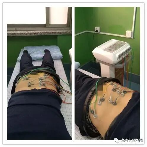 为什么理疗用电极刺激高密人民医院理疗科｜具备传统电针灸功能的新型诊疗设备_https://www.jmylbn.com_新闻资讯_第3张