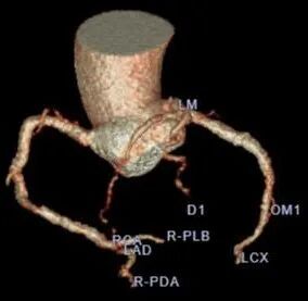 ge ct有哪些型号不怕超重 自由呼吸 ｜ GE Revolution CT显神奇，实现完美冠脉CTA检查！_https://www.jmylbn.com_新闻资讯_第8张