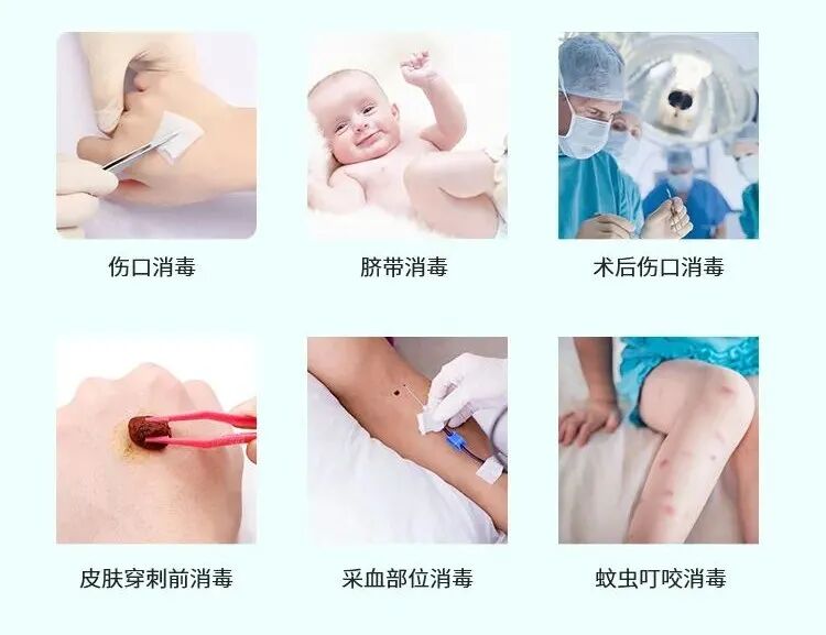 酒精棉签有什么用酒精棉签二合一，日常消毒总相宜_https://www.jmylbn.com_新闻资讯_第10张