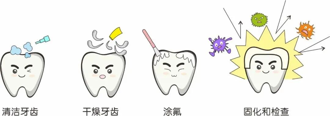 为什么要定期给孩子涂氟涂氟作用大吗