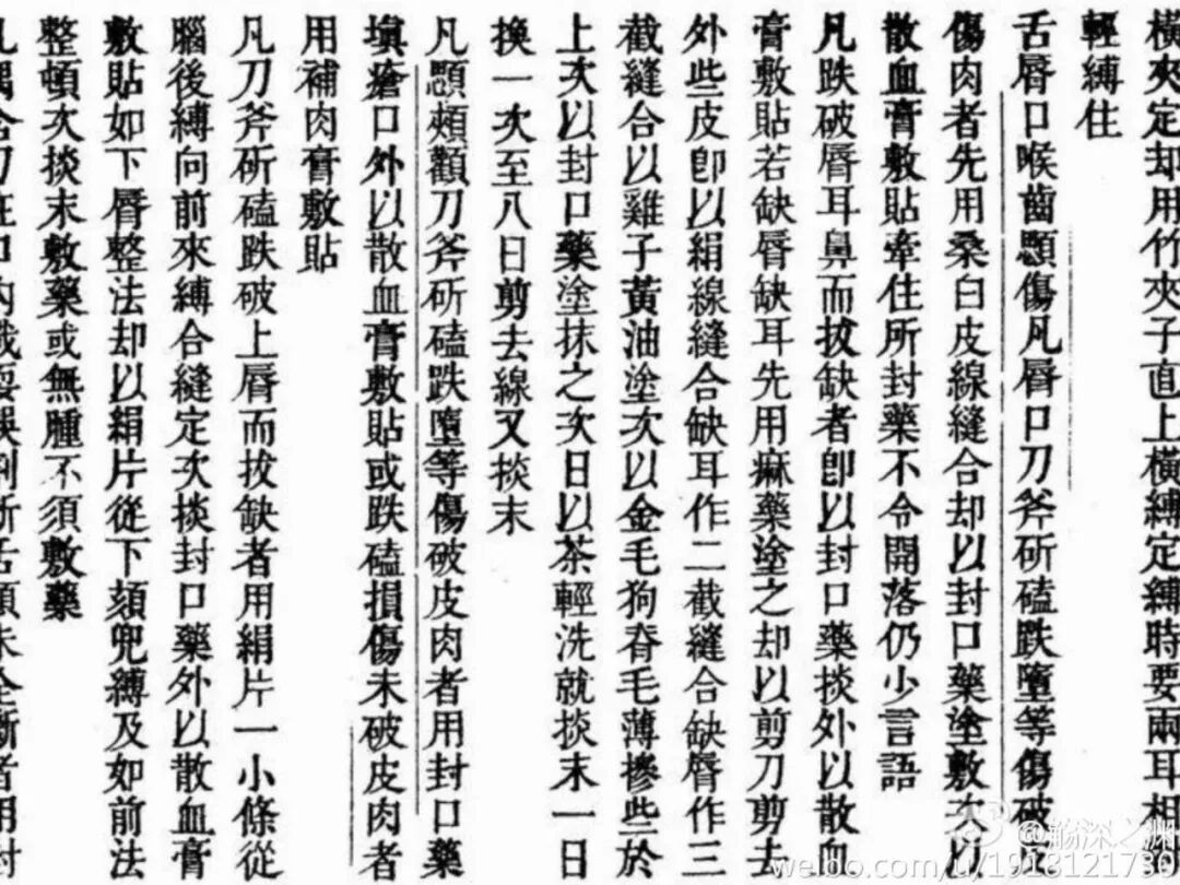 手术剪刀怎么卖中医失传的外科手术（揭秘）_https://www.jmylbn.com_新闻资讯_第10张