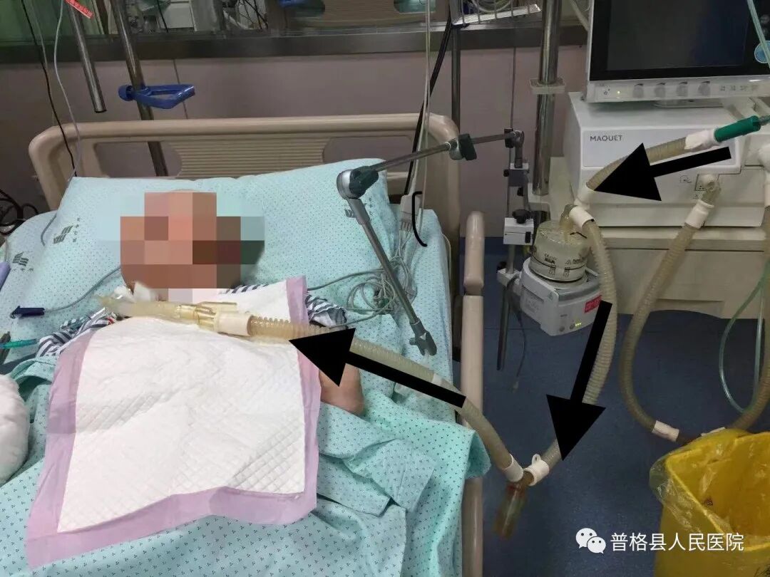 热湿装置怎么安装高流量加温加湿持续吸氧_https://www.jmylbn.com_新闻资讯_第3张