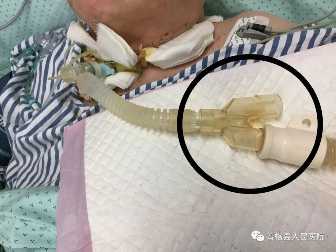 热湿装置怎么安装高流量加温加湿持续吸氧_https://www.jmylbn.com_新闻资讯_第5张