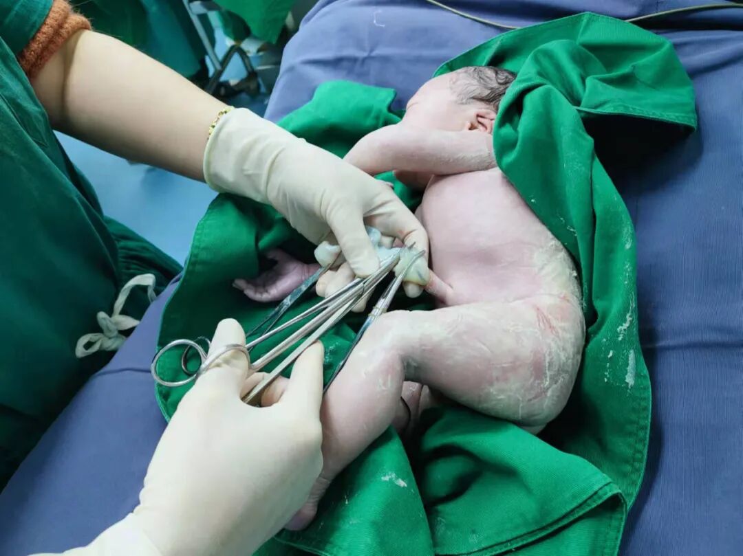 什么叫无影灯走进手术室，你看见了什么？_https://www.jmylbn.com_新闻资讯_第27张