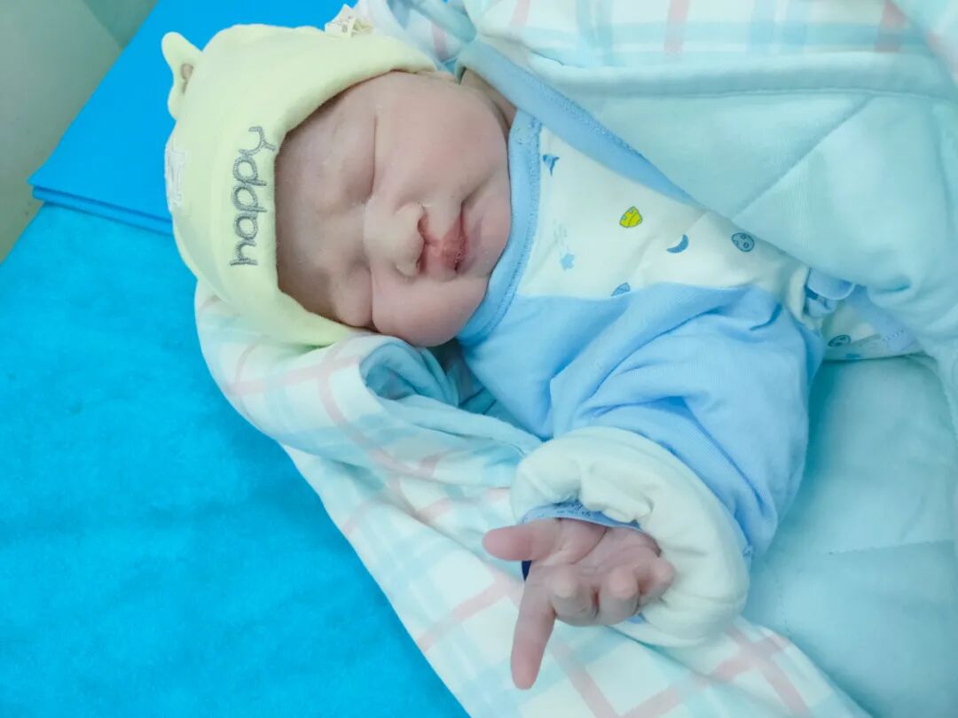 什么叫无影灯走进手术室，你看见了什么？_https://www.jmylbn.com_新闻资讯_第29张