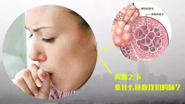 咳嗽的克星居然是它，一年四季潤肺止咳，你們家有嗎？ 健康 第4張