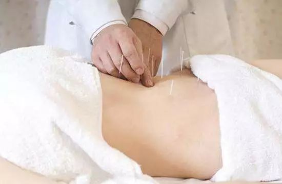 针灸减肥三部曲