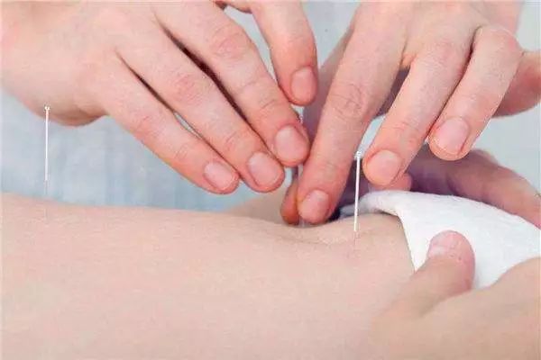 针灸减肥三部曲