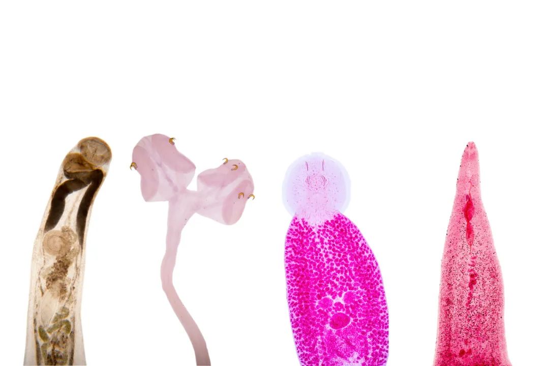 这5种蔬菜别生吃，小心感染寄生虫！一招教你正确清洗蔬菜→