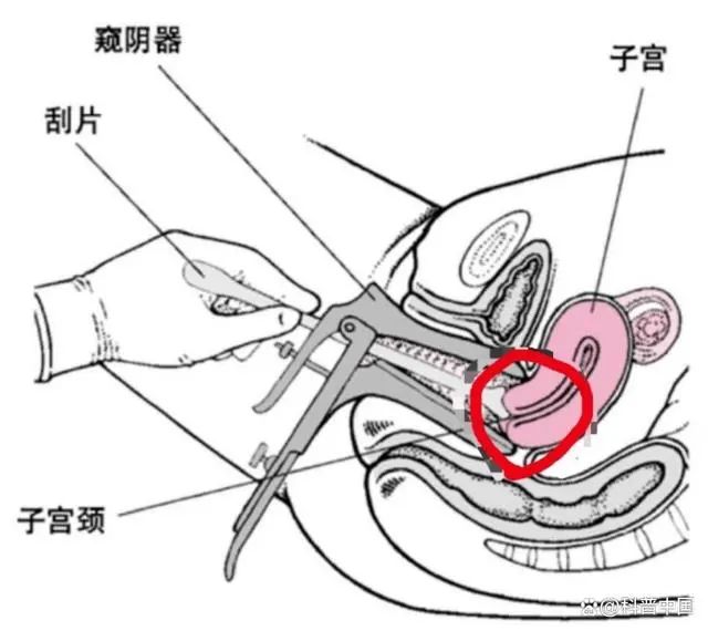 鸭嘴钳为何让女性感到恐惧