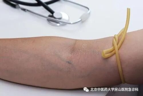 动脉什么压迫止血压迫止血法，您压的方式对了吗？_https://www.jmylbn.com_新闻资讯_第6张