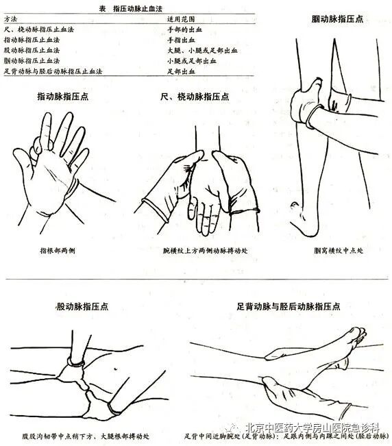 动脉什么压迫止血压迫止血法，您压的方式对了吗？_https://www.jmylbn.com_新闻资讯_第4张