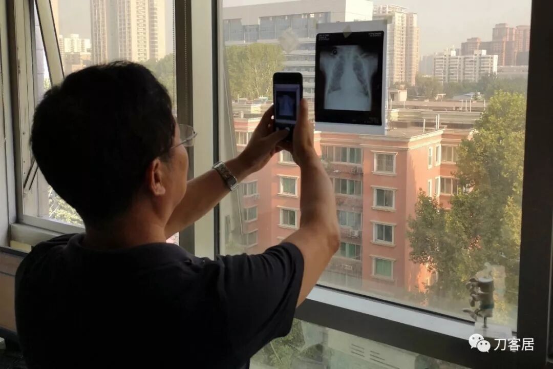 医用阅片灯是什么专业科普！简单又实用的X线片翻拍技术，我只偷偷告诉你_https://www.jmylbn.com_新闻资讯_第15张