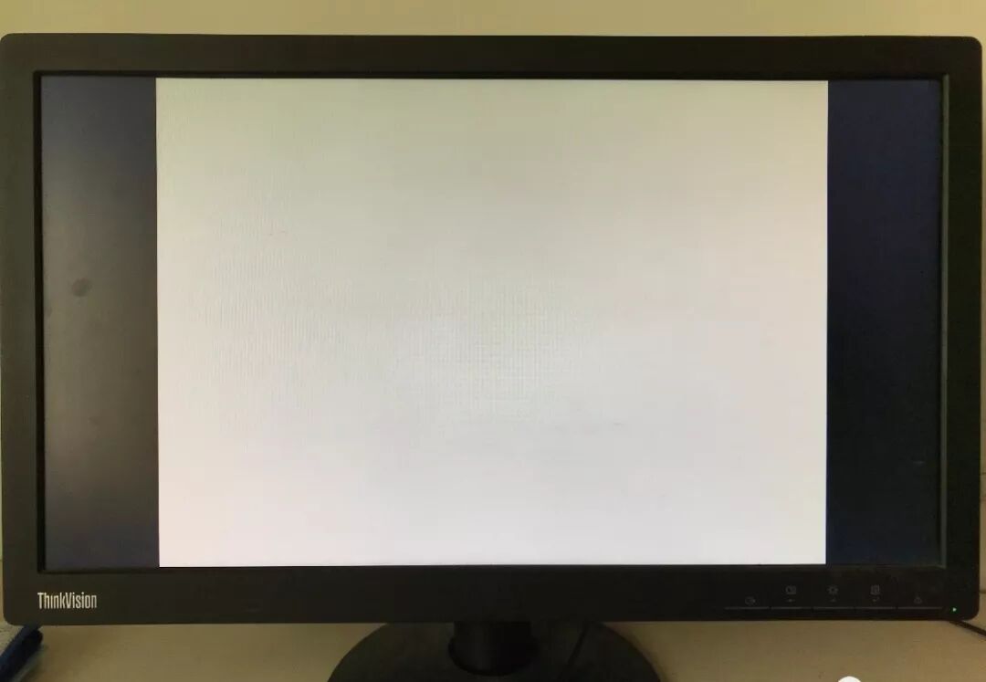 医用阅片灯是什么专业科普！简单又实用的X线片翻拍技术，我只偷偷告诉你_https://www.jmylbn.com_新闻资讯_第12张