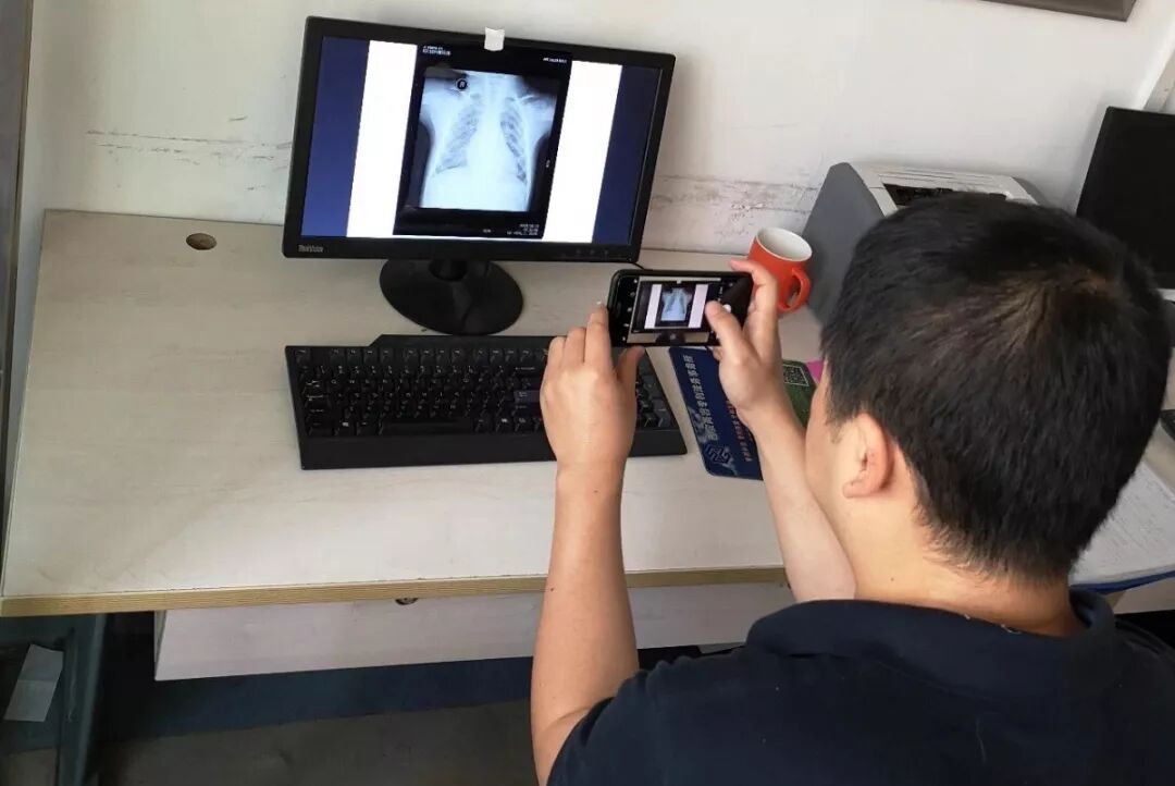 医用阅片灯是什么专业科普！简单又实用的X线片翻拍技术，我只偷偷告诉你_https://www.jmylbn.com_新闻资讯_第16张