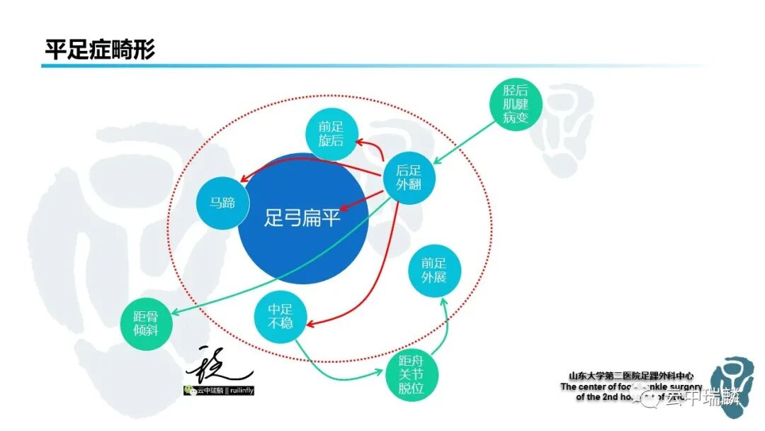 一文了解平足症的病理解剖与治疗策略