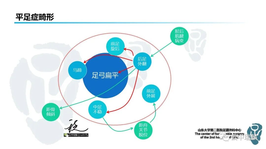 一文了解平足症的病理解剖与治疗策略