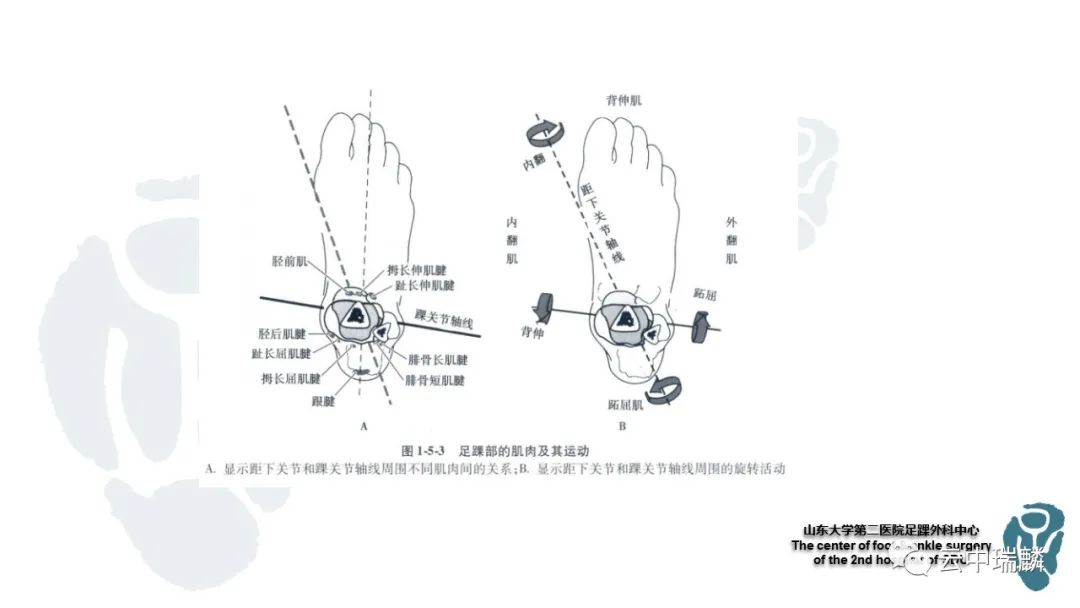 一文了解平足症的病理解剖与治疗策略
