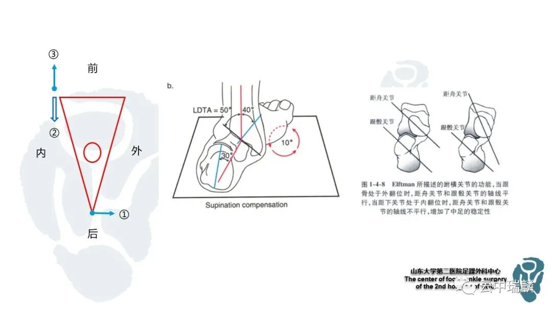 一文了解平足症的病理解剖与治疗策略
