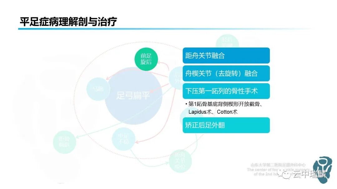 一文了解平足症的病理解剖与治疗策略