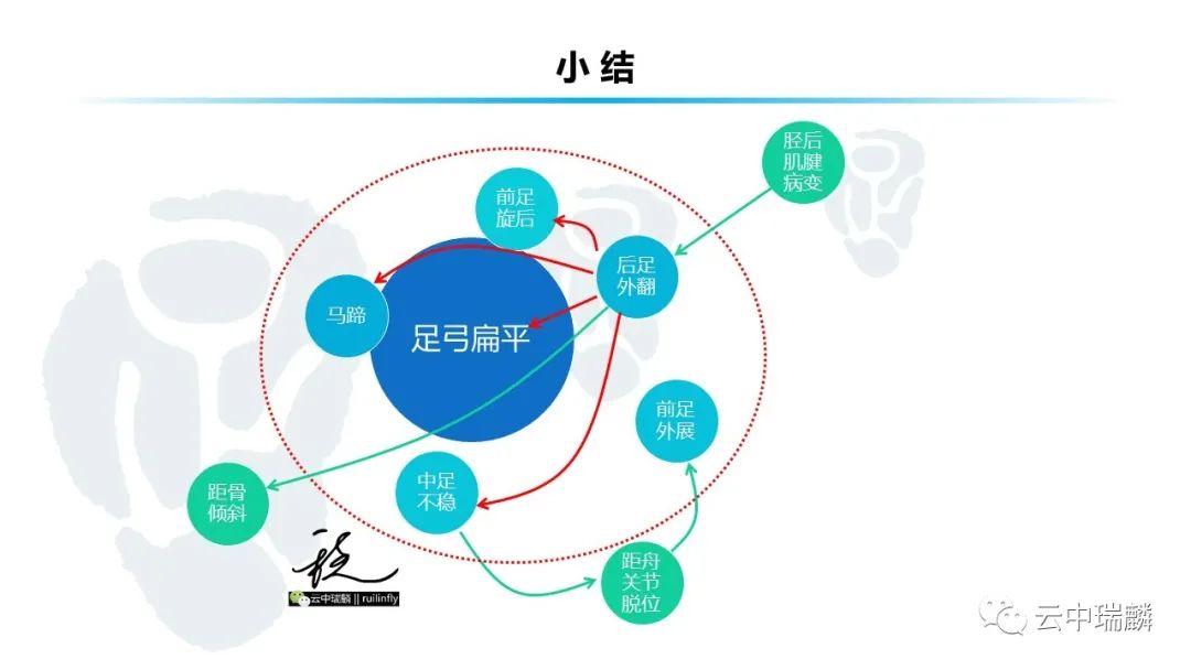 一文了解平足症的病理解剖与治疗策略