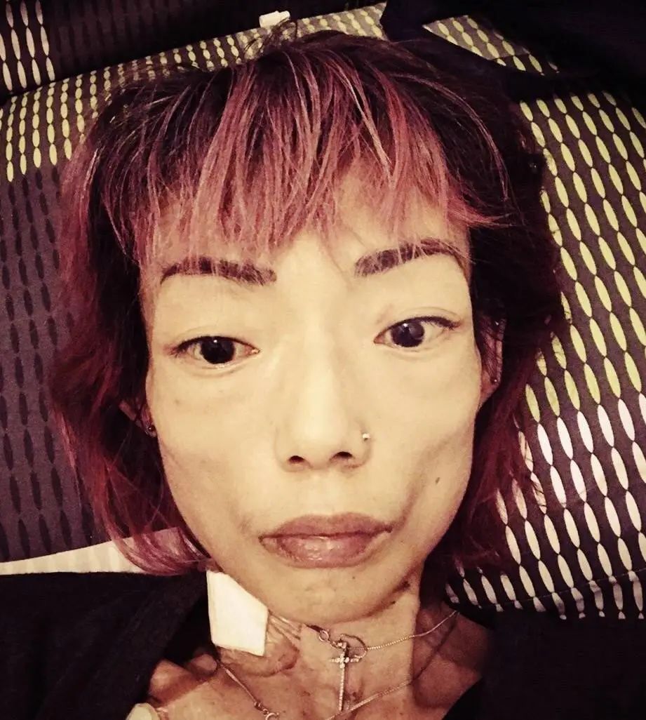 香港得厌食症的女明星图片