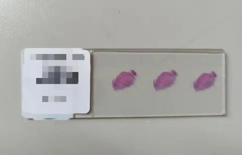 什么是病理蜡块范医•科普 ｜ 病理科的蜡块到底是什么_https://www.jmylbn.com_新闻资讯_第5张