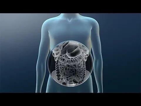 胃造影用的是什么机子【科普园地】胃肠机透视胃肠道病变，影像科创新技术助力健康_https://www.jmylbn.com_新闻资讯_第4张