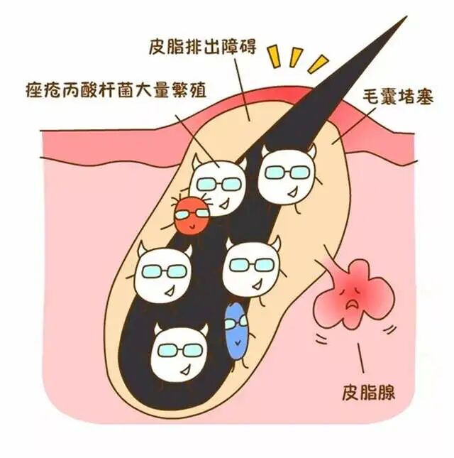 医疗科普·毛囊炎及治疗方法