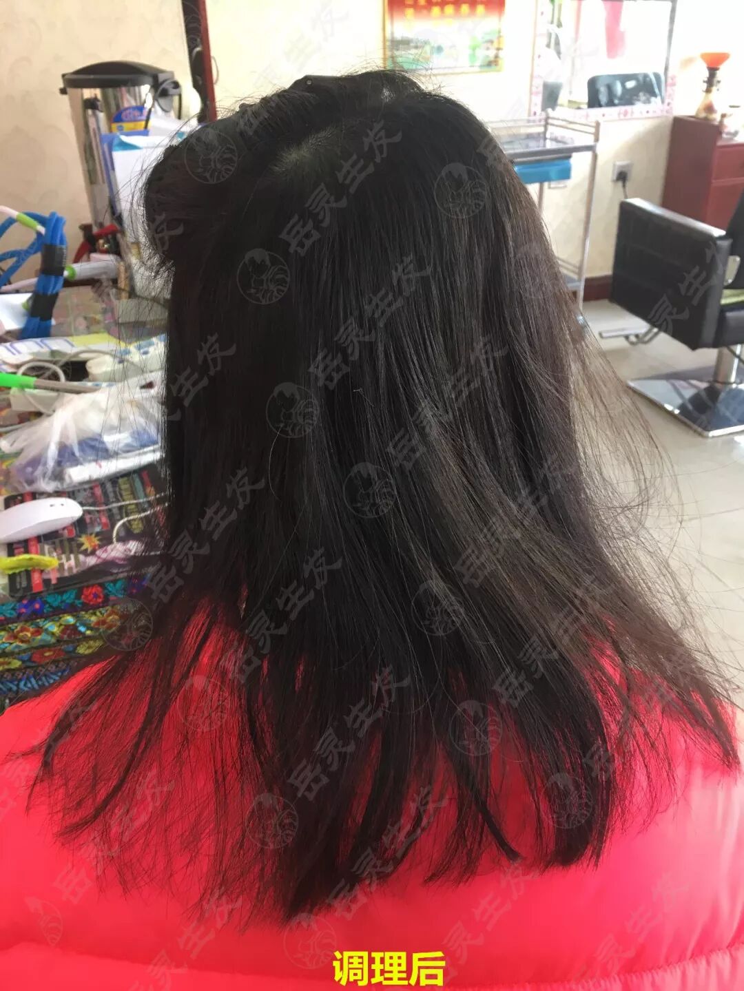 岳灵生发河北沧州海兴店调理后