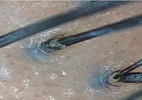 冬天头皮痒痒怎么办？