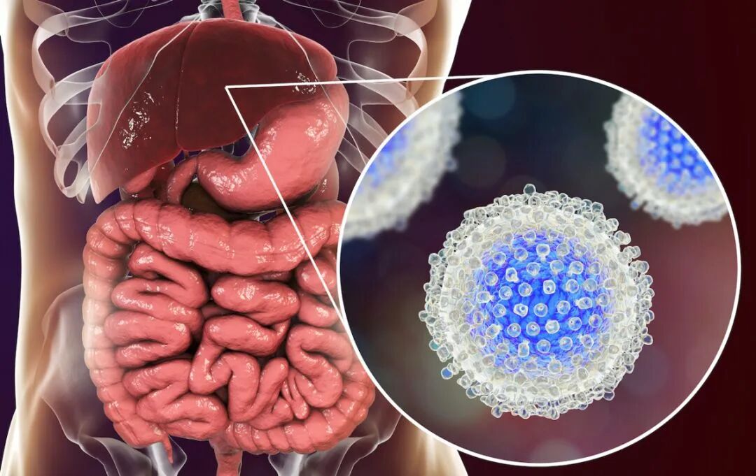 干細(xì)胞療法治療肝硬化臨床研究進(jìn)展